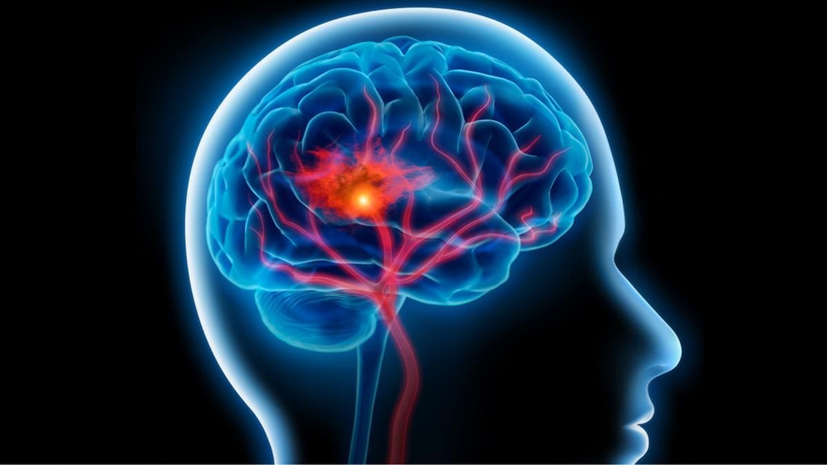 دراسة أميركية: الأطعمة فائقة المعالجة تزيد خطر السكتات الدماغية بنسبة 47%
