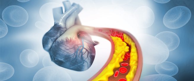 5 أطعمة طبيعية تساهم في تنظيف الشرايين وتحسين صحة القلب