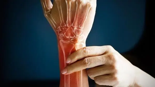 أفضل علاج لآلام المفاصل: الحركة قبل الدواء