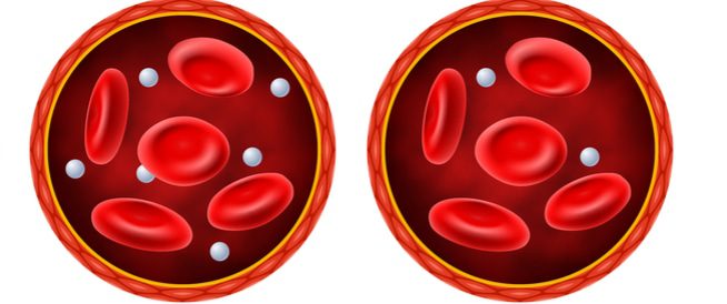 أطعمة "بريئة" ترفع سكر الدم... وخبير يكشف أسرار التحكم به!