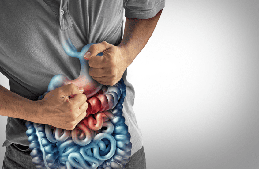 الذكاء الاصطناعي يحلّ لغز داء كرون بعد 25 عامًا من البحث