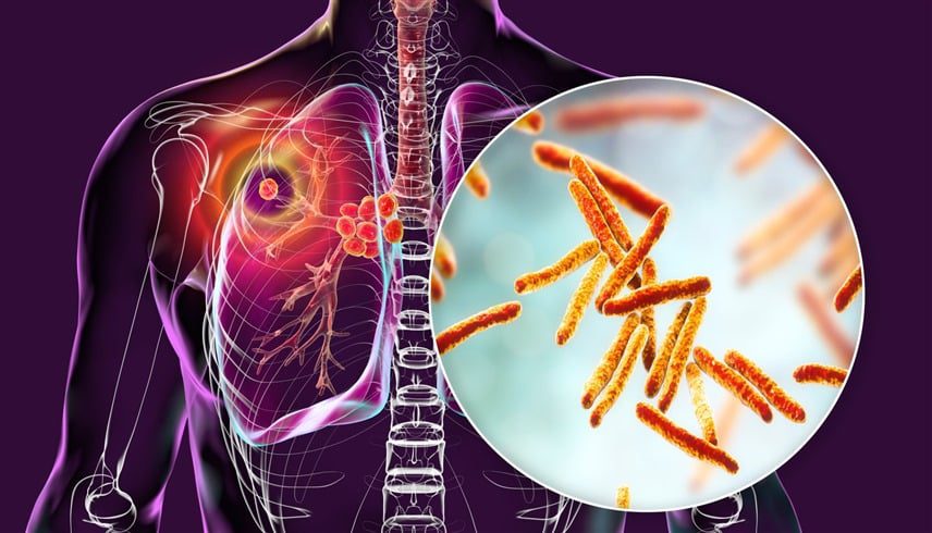  العلم يقترب من التغلب على أخطر مرض في العالم