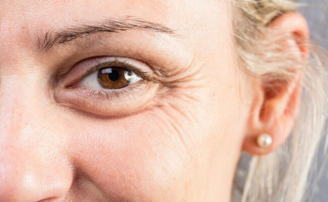 كيف تكشف تجاعيد العينين أسرار صحة الدماغ