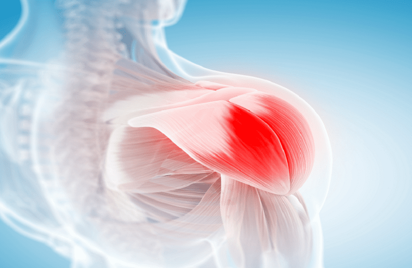 اكتشاف سبب آلام العضلات لدى مستخدمي أدوية الكوليسترول