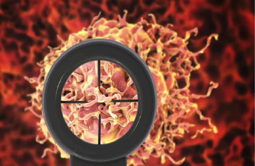 تعبيرية عن سرطان البروستات