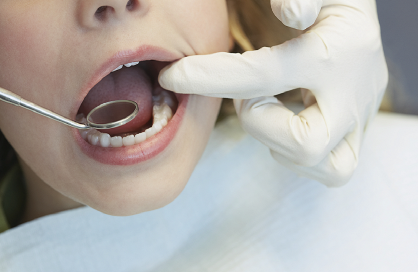 تعبيرية عن الفم