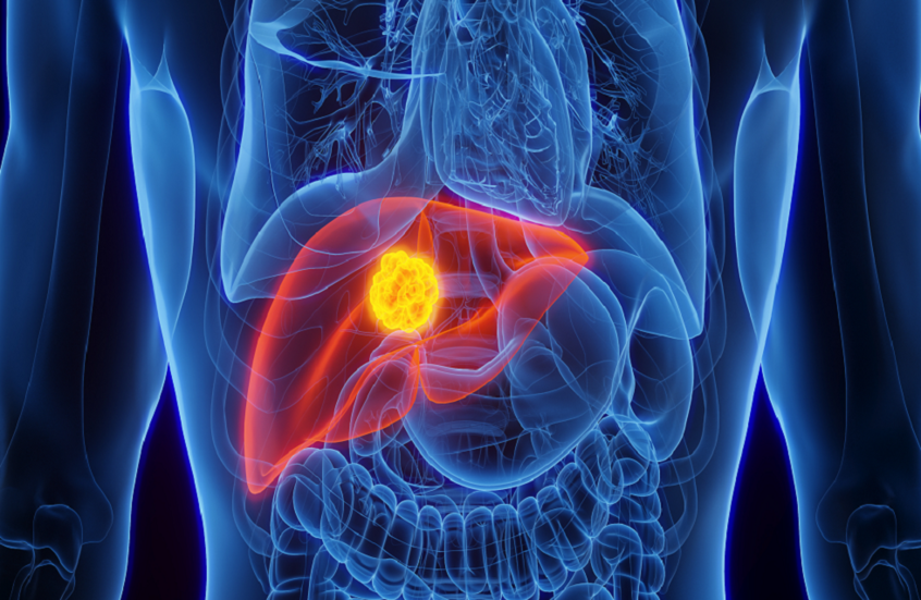 دراسة: التوقف التام عن الكحول يعيد وظائف الكبد حتى في مراحل التليف المتقدم