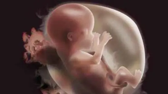 مواد كيميائية موجودة في منزلك قد تؤثر على نمو وجه الأجنة