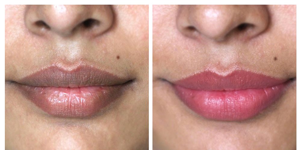 تصبغ الشفاه