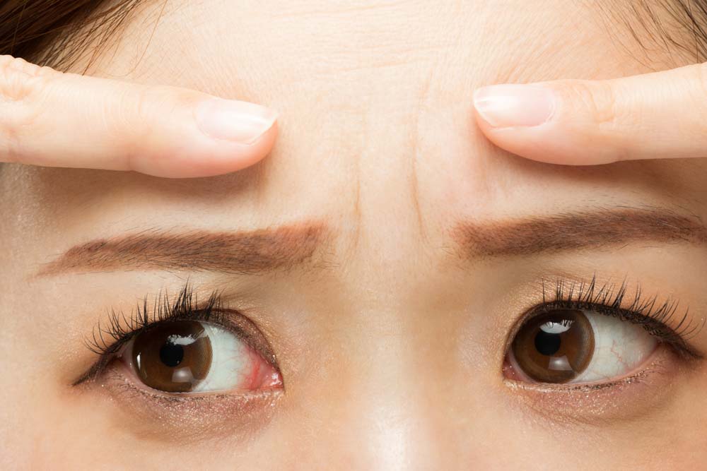 خطوط العبوس